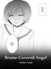 Bruise-Covered Angel